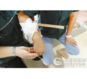 木條彈出刺穿女工手臂 仁慈醫院顯微鏡下7小時取完碎屑